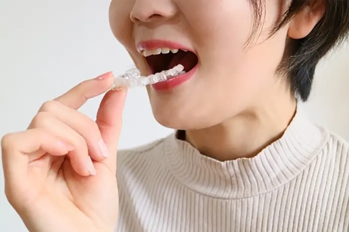マウスピース矯正装置の取り外し